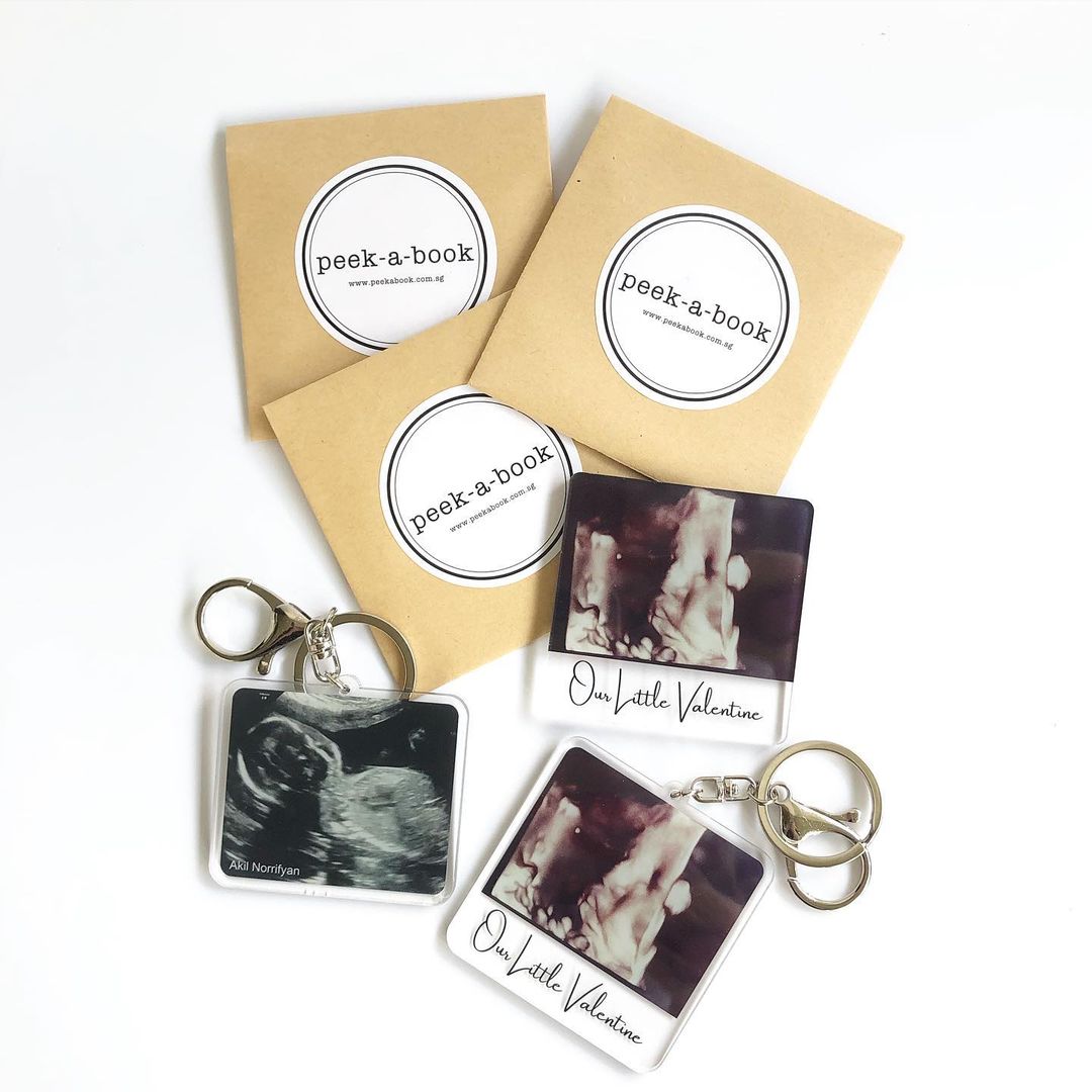 Personalised Sonogram/Ultrasound Acrylic Keychain