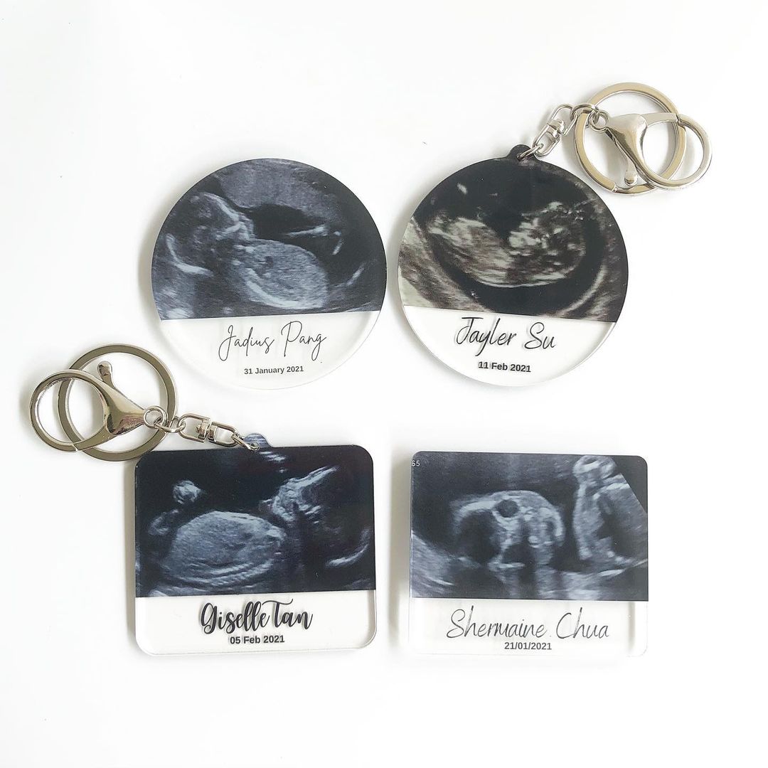 Personalised Sonogram/Ultrasound Acrylic Keychain
