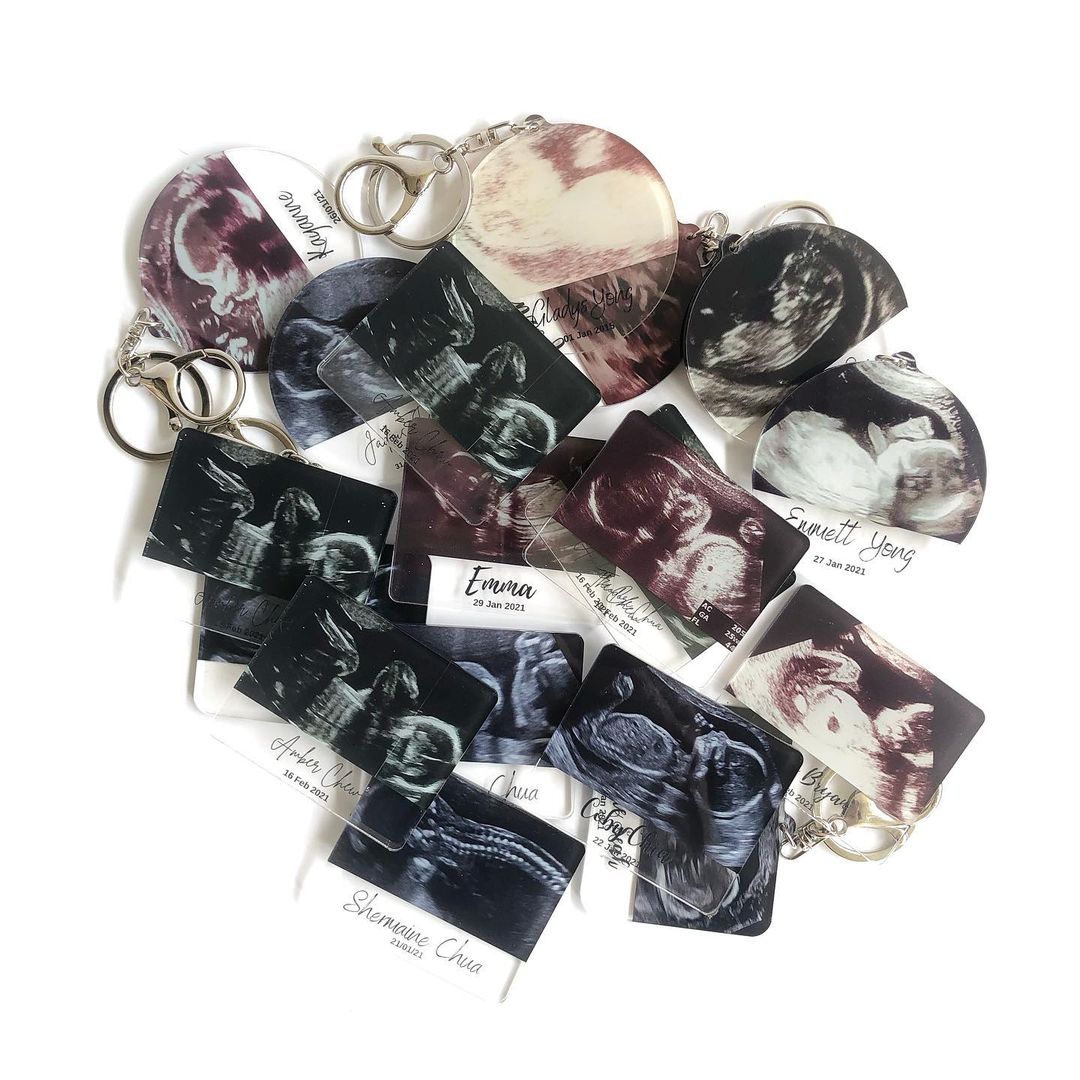 Personalised Sonogram/Ultrasound Acrylic Keychain